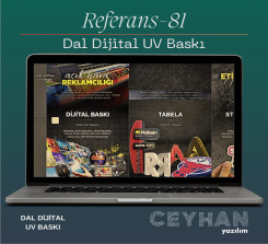 Dal Dijital UV Baskı